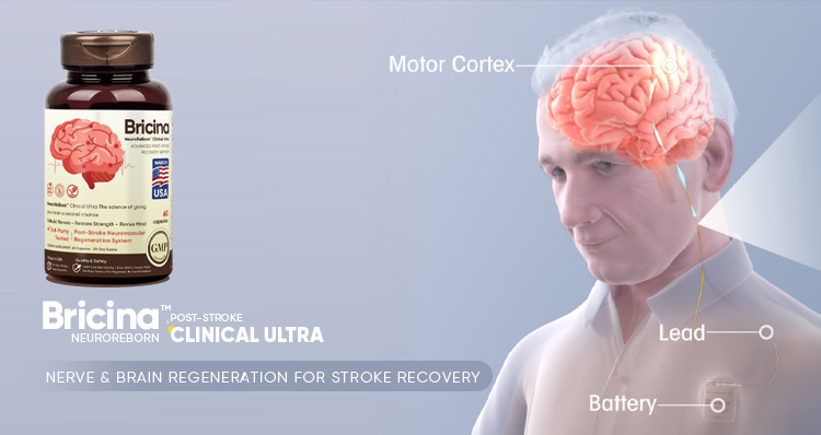NeuroReBorn™ Clinical Ultra: Advanced Nerve & Brain Regeneration for Stroke Recovery